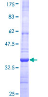 CPA1 / Carboxypeptidase A Protein - 12.5% SDS-PAGE Stained with Coomassie Blue.