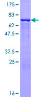 CPA2 Protein - 12.5% SDS-PAGE of human CPA2 stained with Coomassie Blue
