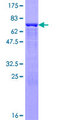 CPA2 Protein - 12.5% SDS-PAGE of human CPA2 stained with Coomassie Blue
