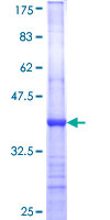 CPA3 Protein - 12.5% SDS-PAGE Stained with Coomassie Blue.
