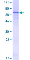 CPB / Carboxypeptidase B Protein - 12.5% SDS-PAGE of human CPB1 stained with Coomassie Blue
