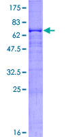 CPB2 / TAFI Protein - 12.5% SDS-PAGE of human CPB2 stained with Coomassie Blue
