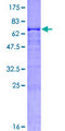 CPB2 / TAFI Protein - 12.5% SDS-PAGE of human CPB2 stained with Coomassie Blue