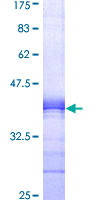 CPB2 / TAFI Protein - 12.5% SDS-PAGE Stained with Coomassie Blue.