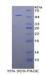 CPE / Carboxypeptidase E Protein - Recombinant Carboxypeptidase E By SDS-PAGE