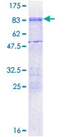CPEB1 / CPEB Protein - 12.5% SDS-PAGE of human CPEB1 stained with Coomassie Blue