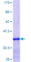 CPEB1 / CPEB Protein - 12.5% SDS-PAGE Stained with Coomassie Blue.