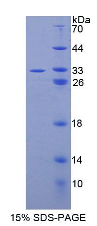 CPEB1 / CPEB Protein - Recombinant Cytoplasmic Polyadenylation Element Binding Protein 1 By SDS-PAGE