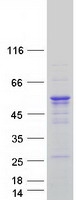 CPEB1 / CPEB Protein - Purified recombinant protein CPEB1 was analyzed by SDS-PAGE gel and Coomassie Blue Staining