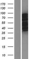 CPEB3 Protein - Western validation with an anti-DDK antibody * L: Control HEK293 lysate R: Over-expression lysate