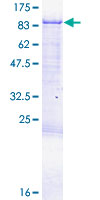 CPEB3 Protein - 12.5% SDS-PAGE of human CPEB3 stained with Coomassie Blue