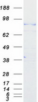 CPEB4 Protein - Purified recombinant protein CPEB4 was analyzed by SDS-PAGE gel and Coomassie Blue Staining