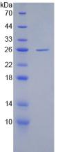 cPLA2 Protein - Recombinant Phospholipase A2, Cytosolic By SDS-PAGE