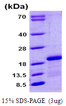 CPLX1 / Complexin 1 Protein