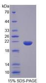 CPLX1 / Complexin 1 Protein - Recombinant Complexin 1 (CPLX1) by SDS-PAGE