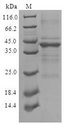 CPLX2 / Complexin 2 Protein - (Tris-Glycine gel) Discontinuous SDS-PAGE (reduced) with 5% enrichment gel and 15% separation gel.
