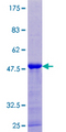CPLX3 Protein - 12.5% SDS-PAGE of human CPLX3 stained with Coomassie Blue