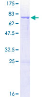 CPM / Carboxypeptidase M Protein - 12.5% SDS-PAGE of human CPM stained with Coomassie Blue