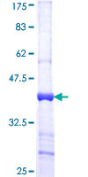 CPM / Carboxypeptidase M Protein - 12.5% SDS-PAGE Stained with Coomassie Blue.