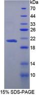 CPN1 Protein - Recombinant Carboxypeptidase N1 By SDS-PAGE