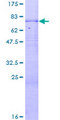 CPN1 Protein - 12.5% SDS-PAGE of human CPN1 stained with Coomassie Blue