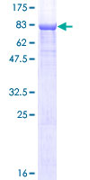 CPNE1 / Copine I Protein - 12.5% SDS-PAGE of human CPNE1 stained with Coomassie Blue