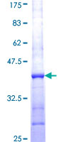 CPNE1 / Copine I Protein - 12.5% SDS-PAGE Stained with Coomassie Blue.