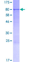 CPNE2 Protein - 12.5% SDS-PAGE of human CPNE2 stained with Coomassie Blue