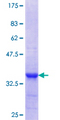CPNE3 Protein - 12.5% SDS-PAGE Stained with Coomassie Blue.