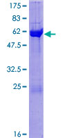 CPNE5 Protein - 12.5% SDS-PAGE of human CPNE5 stained with Coomassie Blue