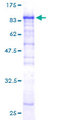 CPNE6 / N-COPINE Protein - 12.5% SDS-PAGE of human CPNE6 stained with Coomassie Blue