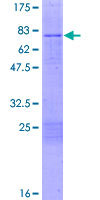 CPOX Protein - 12.5% SDS-PAGE of human CPOX stained with Coomassie Blue