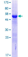 CPPED1 Protein - 12.5% SDS-PAGE of human FLJ11151 stained with Coomassie Blue