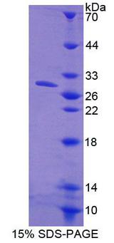 CPPED1 Protein - Recombinant Calcineurin Like Phosphoesterase Domain Containing Protein 1 (CPPED1) by SDS-PAGE