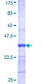 CPS1 Protein - 12.5% SDS-PAGE Stained with Coomassie Blue.