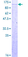 CPSF2 Protein - 12.5% SDS-PAGE of human CPSF2 stained with Coomassie Blue