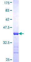 CPSF3 / CPSF Protein - 12.5% SDS-PAGE Stained with Coomassie Blue.