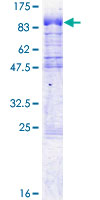 CPSF6 Protein - 12.5% SDS-PAGE of human CPSF6 stained with Coomassie Blue