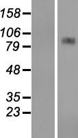 CPT1A Protein - Western validation with an anti-DDK antibody * L: Control HEK293 lysate R: Over-expression lysate