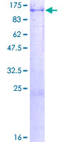 CPT1A Protein - 12.5% SDS-PAGE of human CPT1A stained with Coomassie Blue