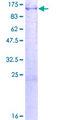 CPT1A Protein - 12.5% SDS-PAGE of human CPT1A stained with Coomassie Blue