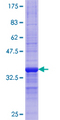 CPT1A Protein - 12.5% SDS-PAGE Stained with Coomassie Blue.