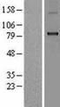CPT1B Protein - Western validation with an anti-DDK antibody * L: Control HEK293 lysate R: Over-expression lysate