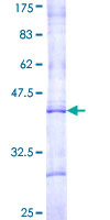 CPT1B Protein - 12.5% SDS-PAGE Stained with Coomassie Blue.