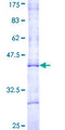 CPT1B Protein - 12.5% SDS-PAGE Stained with Coomassie Blue.