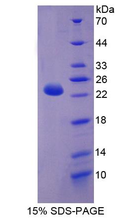 CPT1B Protein - Recombinant Carnitine Palmitoyltransferase 1B, Muscle By SDS-PAGE