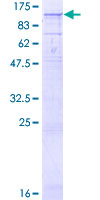 CPT1C Protein - 12.5% SDS-PAGE of human CPT1C stained with Coomassie Blue