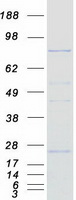 CPT1C Protein - Purified recombinant protein CPT1C was analyzed by SDS-PAGE gel and Coomassie Blue Staining
