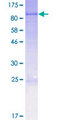 CPT2 Protein - 12.5% SDS-PAGE of human CPT2 stained with Coomassie Blue