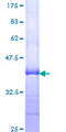 CPT2 Protein - 12.5% SDS-PAGE Stained with Coomassie Blue.